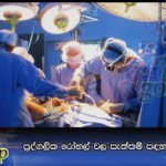 පුද්ගලික රෝහල් වල සැත්කම් සඳහා උපරිම මිලක්