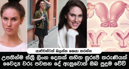 ලෝකෙම කතාවෙන උපතින්ම ස්ත්‍රී ලිංග දෙකක් සහිත සුරූපී තරුණියගේ කතාව මෙන්න…