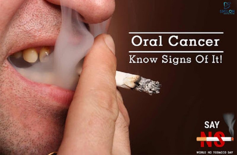 දුම්කොළ සහ මත්පැන්වලින් වැළකී මුඛ පිළිකාවෙන් ගැළවෙමු !