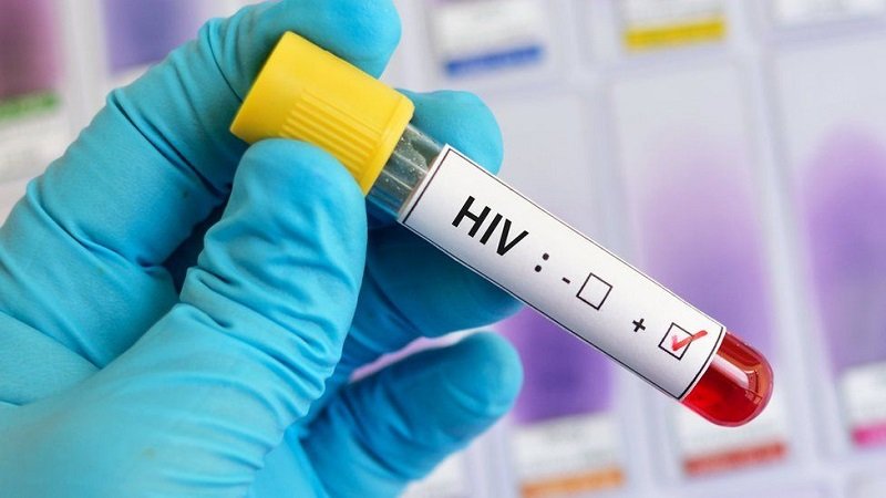ඖෂධ භාවිතයෙන් තොරව HIV ‘සුවකිරීමේ හැකියාවක්’ – සුපිරි සොයා ගැනීමේ කතාව