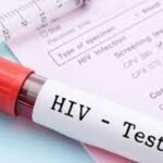 ශ්‍රී ලංකාවේ HIV/AIDS රෝගීන් වාර්තාගත ලෙස ඉහළට