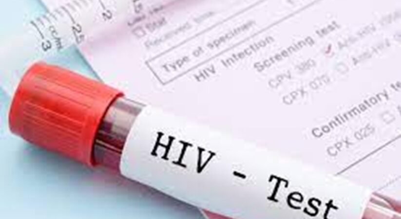 ශ්‍රී ලංකාවේ HIV/AIDS රෝගීන් වාර්තාගත ලෙස ඉහළට