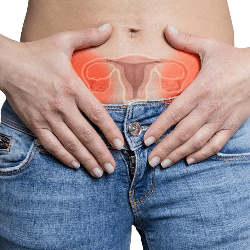 ඩිම්බකෝෂ පිළිකා රෝගීන්ට සුභ ආරංචියක්